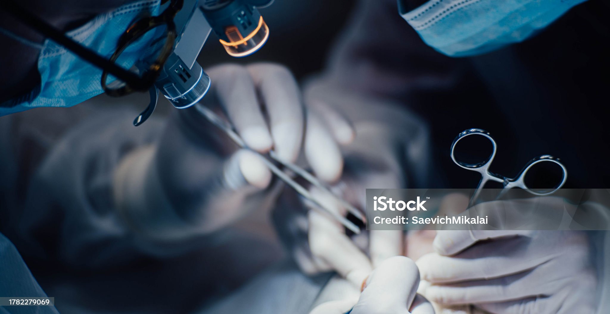 Neurocirurgia pediátrica minimamente invasiva no Hospital Regional do Oeste - HRO